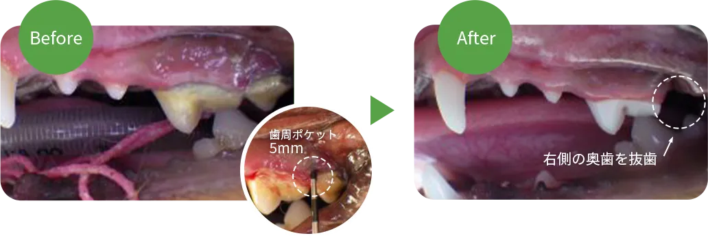 歯周病の治療事例