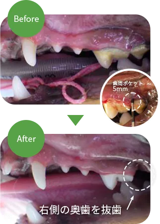 歯周病の治療事例