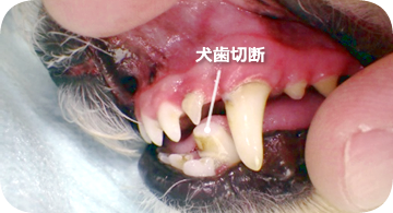 生活歯髄切断処置