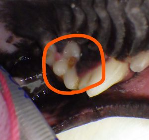 虫歯（う蝕）の症例